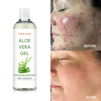 Organic Aloe Vera Gel for Face, Body, and After Sun Relief - Private Label