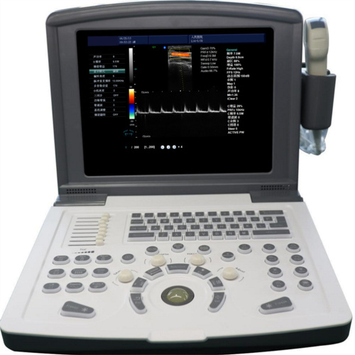 Portable Color Doppler Ultrasound Machine for Abdomen