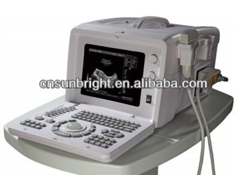 vivid ultrasound