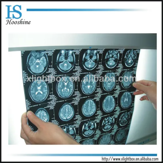 X-ray film observation lamp/ negatoscope