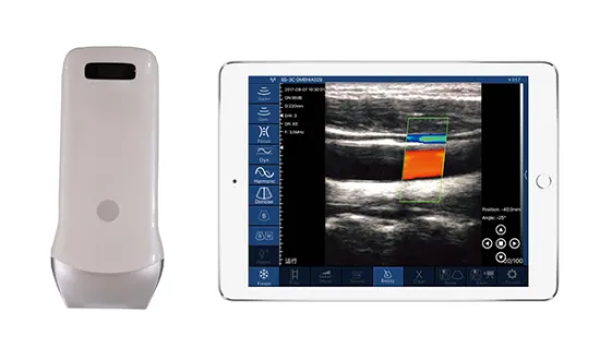 80E Linear Mini Ultrasound scanner