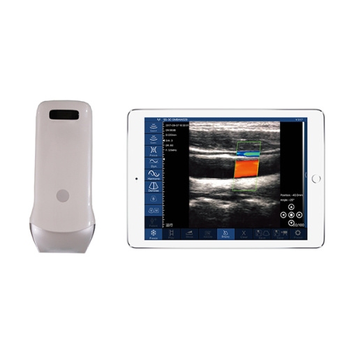 Handhållen ultraljudsmaskin iPad ultraljudsscanner
