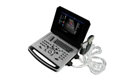 Notebook Color Doppler Ultrasound Scanner Machine