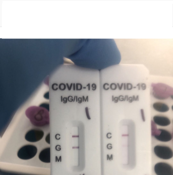 covid-19 IgG/IgM rapid test