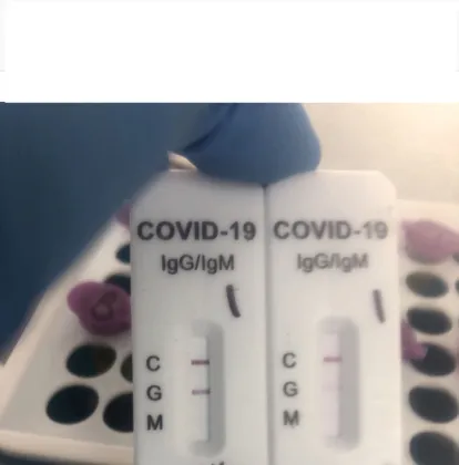 covid-19 IgG/IgM rapid test