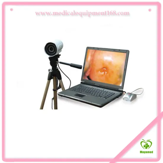 MY-F003 portable Electronic video Colposcope