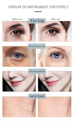 2023 Hot Pore Minimizer and Skin Care Beauty Instruments