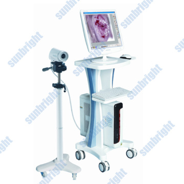 video colposcope supplier colposcope prices