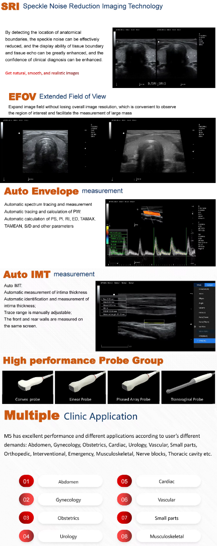 Full Digital Color Doppler Ultrasonic Diagnostic Instruments