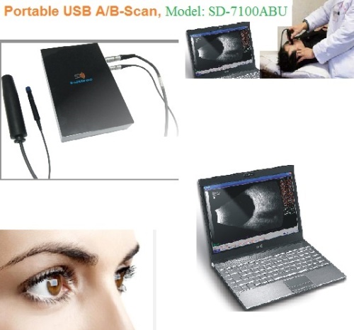 Portable USB Ophthalmic Ab Scan, Ophthalmic Ab Ultrsound (SD-7100ABU)