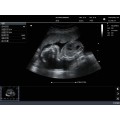 Ультрагукавой апарат Krayson KC90 Color Doppler