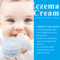 Melhor creme de alívio de tratamento de eczema de ervas bebês