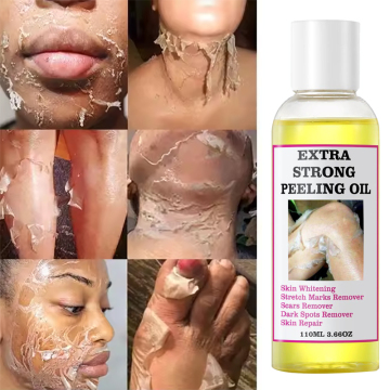 Custom Low MOQ Yellow Peeling Oil mit Privatbezeichnung für die Hautpflege