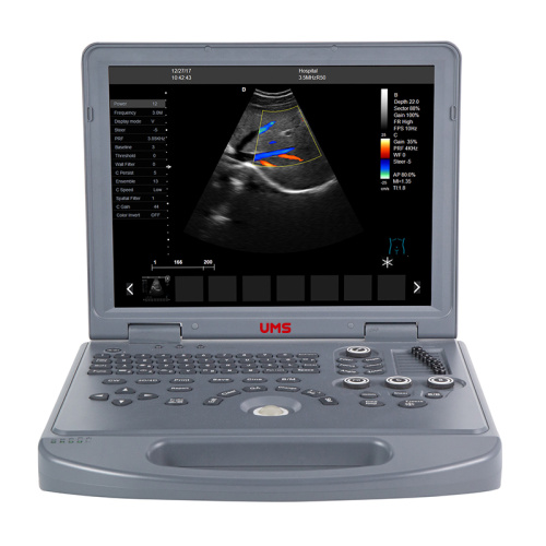 Scanner de ultra-som Doppler em cores para laptop UW-L3