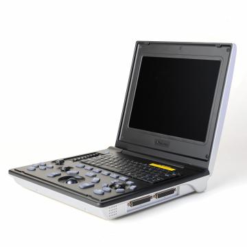 Жаночы дыягнастычны інструмент панкрэатыту ўльтрагукавога даследавання