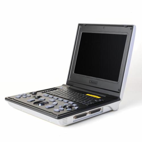 Жаночы дыягнастычны інструмент панкрэатыту ўльтрагукавога даследавання