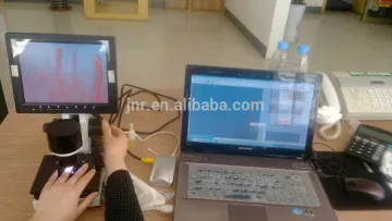 Health Caring Capillaroscope Microcirculation Microscope