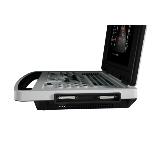 Notebook Color Doppler Ultrasound Scanner for Obstetrics