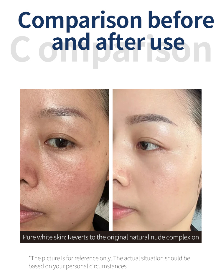 High-Pressure Skin Infusion