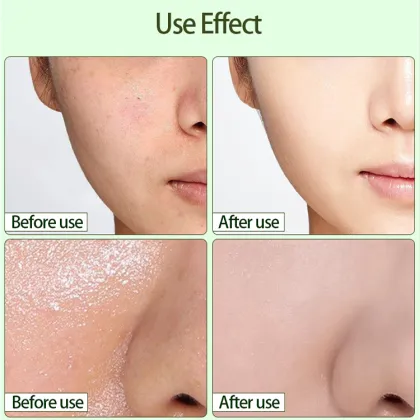 Greenmask Stick Facial Mask - Wholesale Skincare Clay Mask Factory Customization