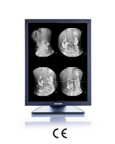 2MP 20-Inch 1600X1200 LCD Screen Monochrome Monitor, CE Approved, Digital Dental Panoramic X Ray