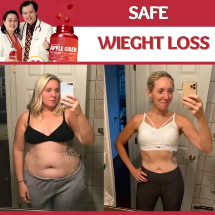 OEM Customized Weight Loss Apple Cider Vinegar Gummy