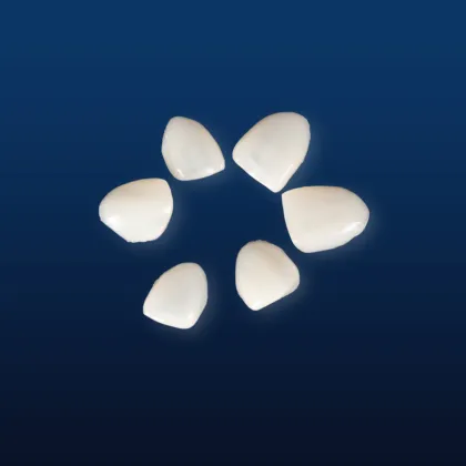 IPS Emax Dental Restorations