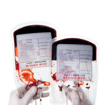 Túi thu gom máu của Siny với thuốc chống đông máu