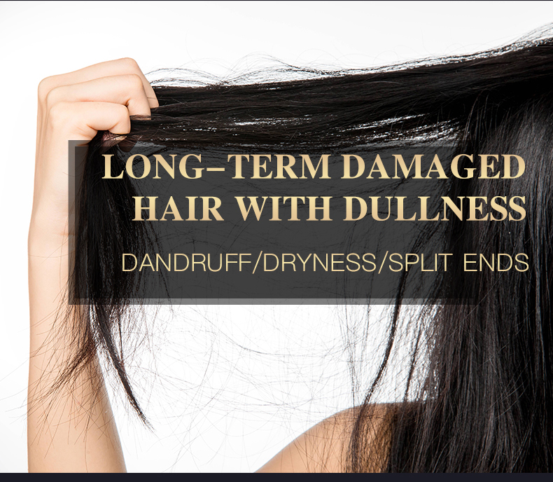 Dandruff Removing Hair Dullness Shampoo