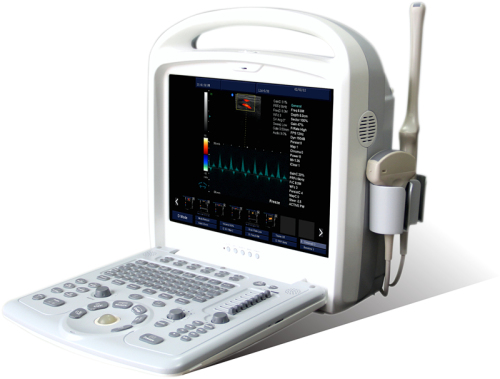 Portable Ultrasound Color Doppler Sonoace