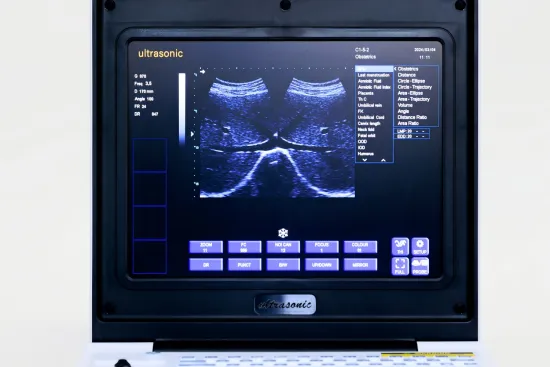 Children gastric ulcer ultrasound diagnostic instrument