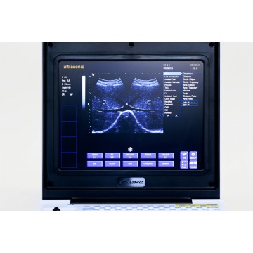 Дзеці страўнікавай язвавай ультрагукавой дыягностыкі