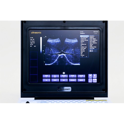 Дзеці страўнікавай язвавай ультрагукавой дыягностыкі