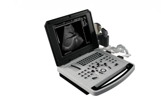 Notebook Black and White Ultrasound Machine for Obstetrics