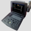 Scanner de ultrassom doppler portátil