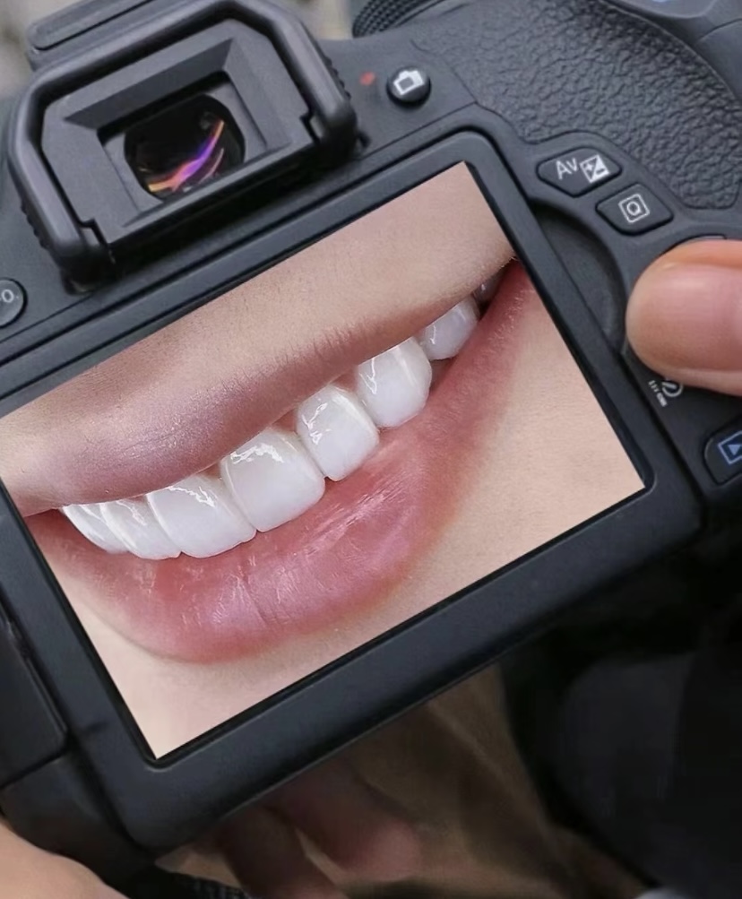 impiallacciatura veneer