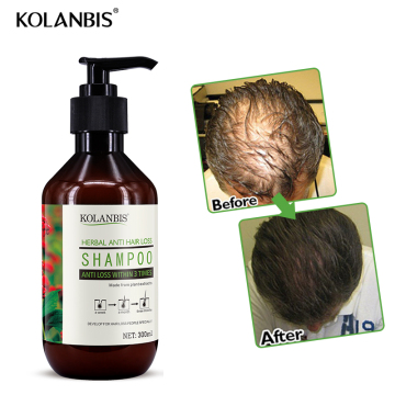 Organic 300ml Shampoo for Faster Hair Growth and Baldness Cure