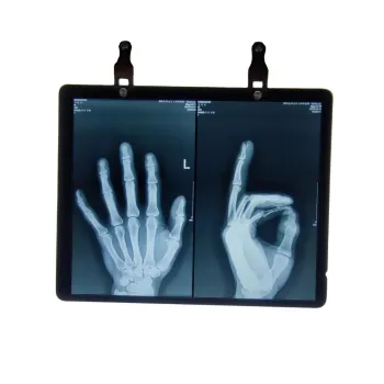 Fujifilm DILH 10x14 Laser Medical X-ray Film for DryPix Printers