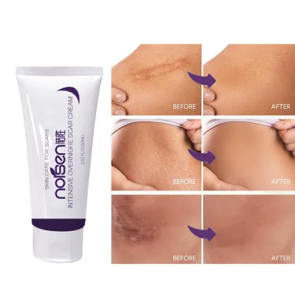 Best Wholesale Scar and Stretch Mark Removal Cream
