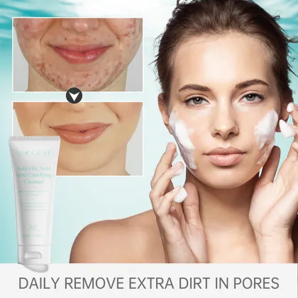 Salicylic Acid Cleanser for Acne and Oily Skin: Gentle Exfoliating Foaming Cream