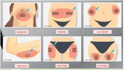 The Red Slimming Ampoules/ Weight Loss Lipolysis Solution Red Ampoule 10ml Slimming Body Weight Loss