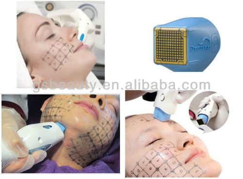 Thermage CPT skin rejuvenation matrix RF