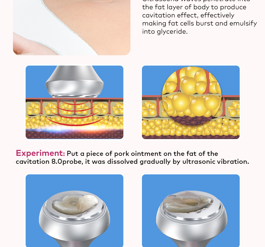 cavitation weight loss