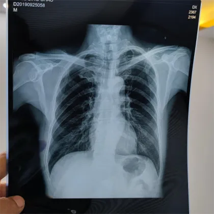 CT Scan Film for Fuji DI-HL Drypix Imaging Printer