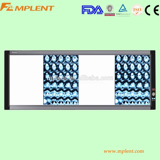 Duadruple super slim x ray viewer