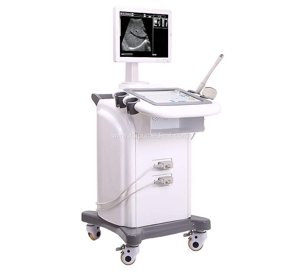 B/W Trolley Ultrasound Scanner Good Price Ultrasound Machine