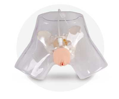 Transparent Uterine Curettage Modela