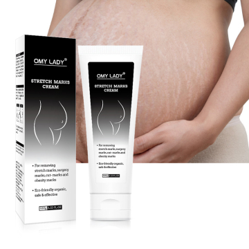 Omy Lady Sterch Marks Cream Επίσημη ιστοσελίδα