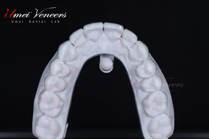 Strong zirconium oxide veneers