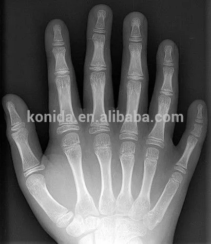 KND-F fuji drypix 2000 dry film 8*10inch China Supplier